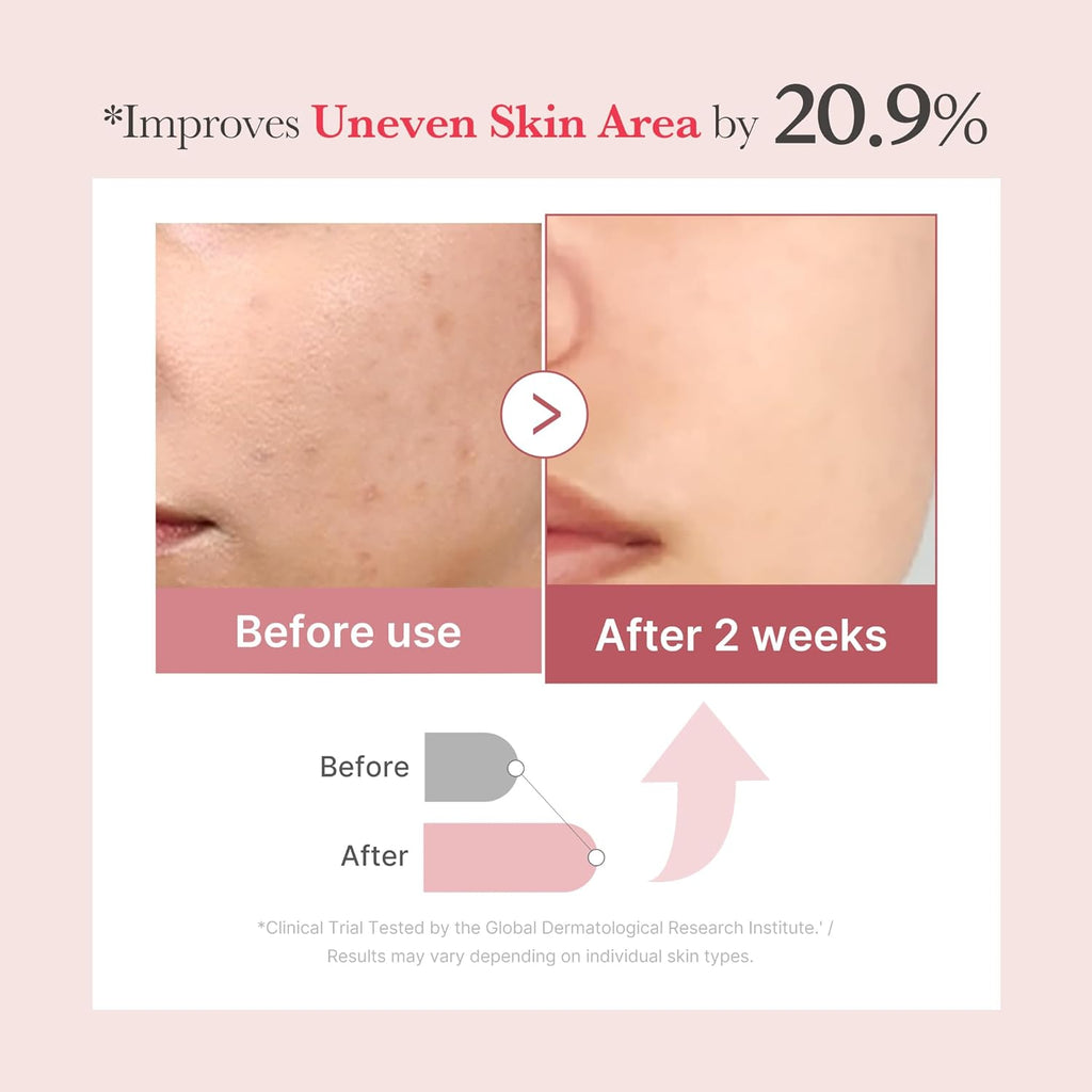 Exosome Shot PDRN Pink Collagen 7,500 PPM Spicule Facial Serum | Liquid Skin Booster | Exosome, Salmon DNA Spicules | Uneven Skin Tone, Pore Care, Skin Texture | Korean Skincare, 1.01 Fl.Oz