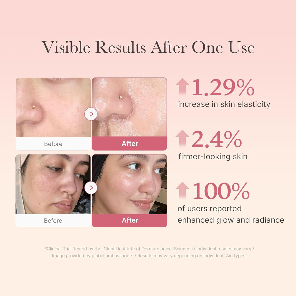 Collagen Jelly Cream- Niacinamide & Freeze-Dried Hydrolyzed Collagen - Boosts Skin'S Barrier Hydration and Gives 24H Glow & Lifted Look - Korean Skincare (1.69 Fl Oz (Pack of 1))